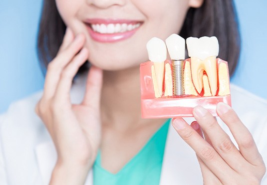 A dentist holding a model of a dental implant in the jaw